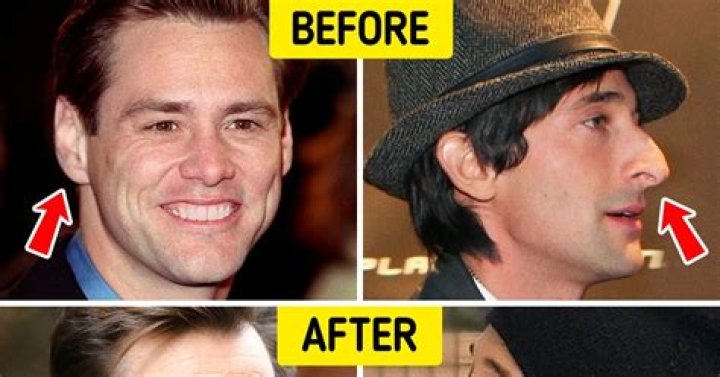 Does your nose keep growing?