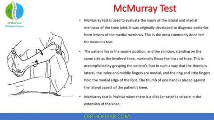 Is the McMurray test accurate?