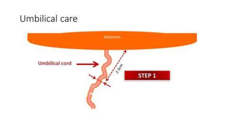 Should I cut the umbilical cord of a kitten?