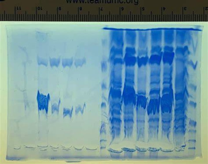 What causes smearing in SDS PAGE?